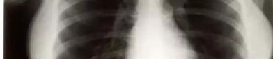 直播中女孩裸露的胸片,网友热议道德底线